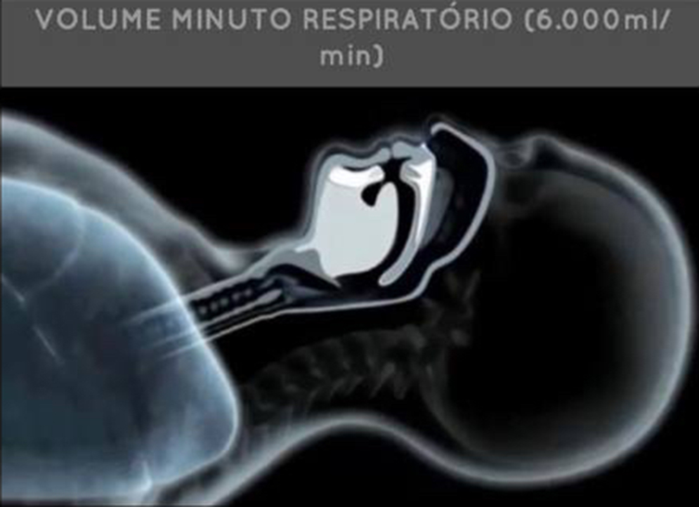 Diagnóstico e intervenção para a apneia obstrutiva do sono (AOS).
