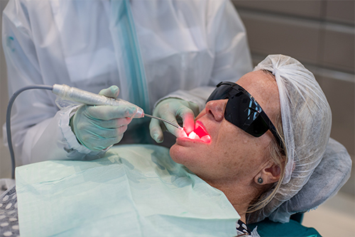 Hipersensibilidade Dentária x  Laserterapia na Odontologia