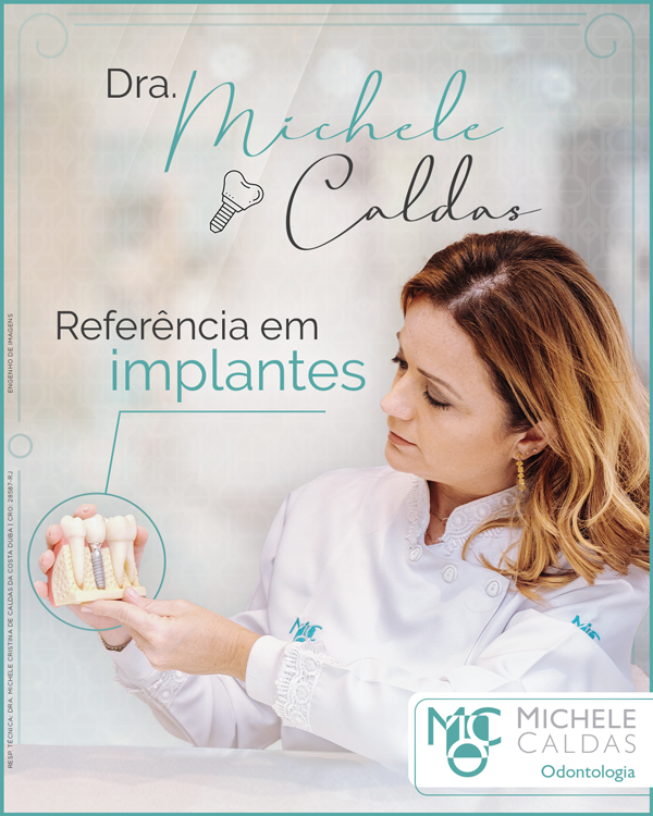 Dra. Michele Caldas: referência em implantes