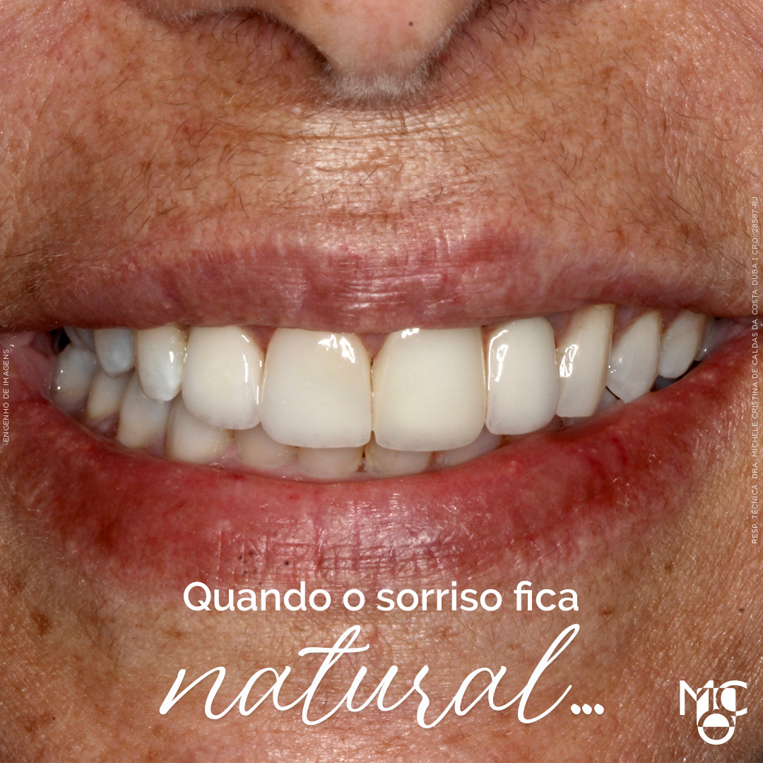 Como é grandioso começar a semana e ver meus pacientes SORRINDO.