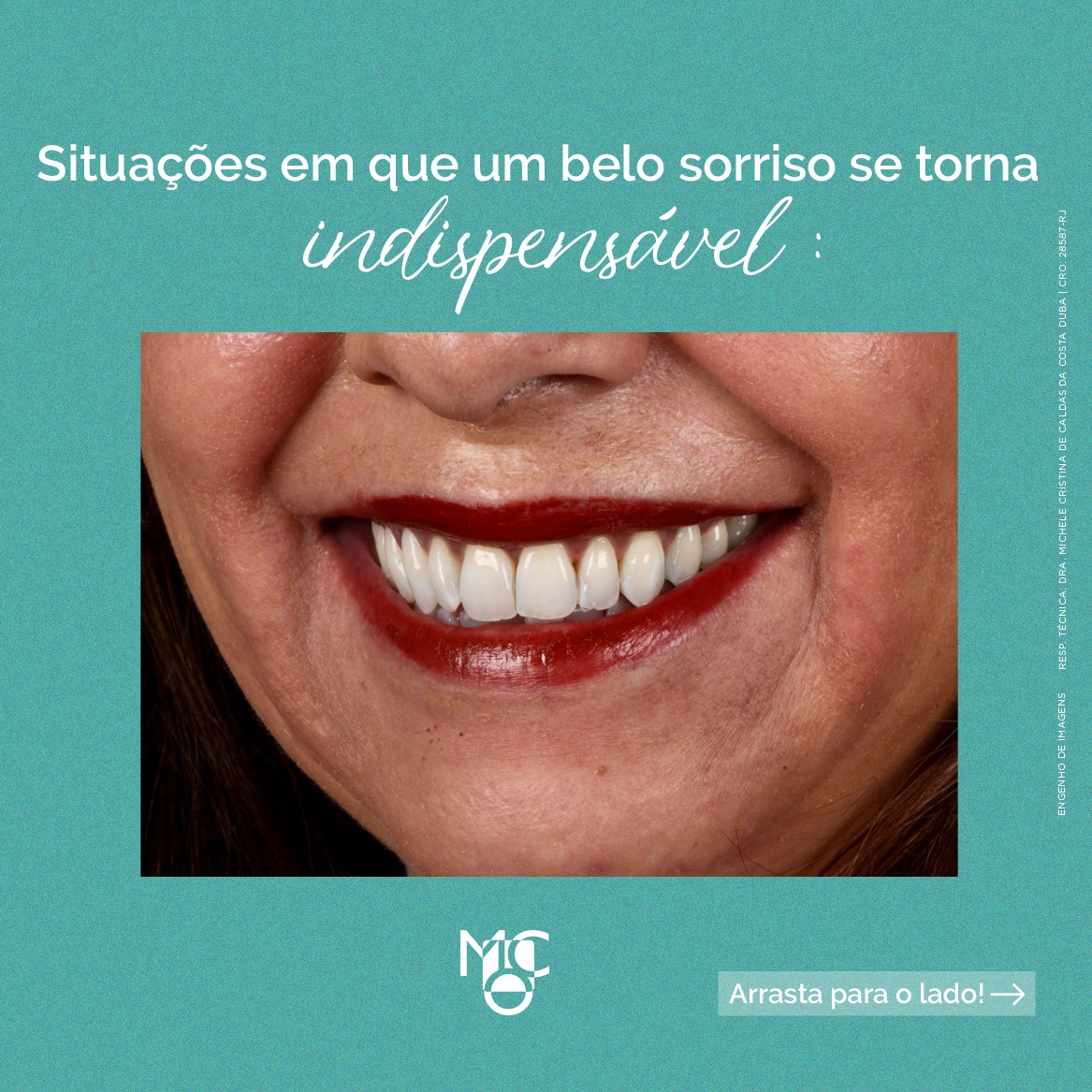 TER UM BELO SORRISO SE TORNA INDISPENSÁVEL