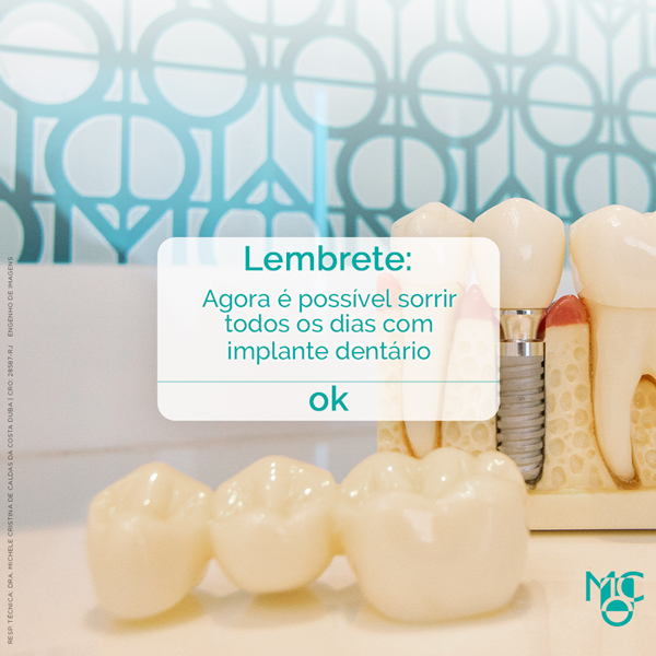 Lembrete: agora eu posso sorrir todos os dias com implante dentário!