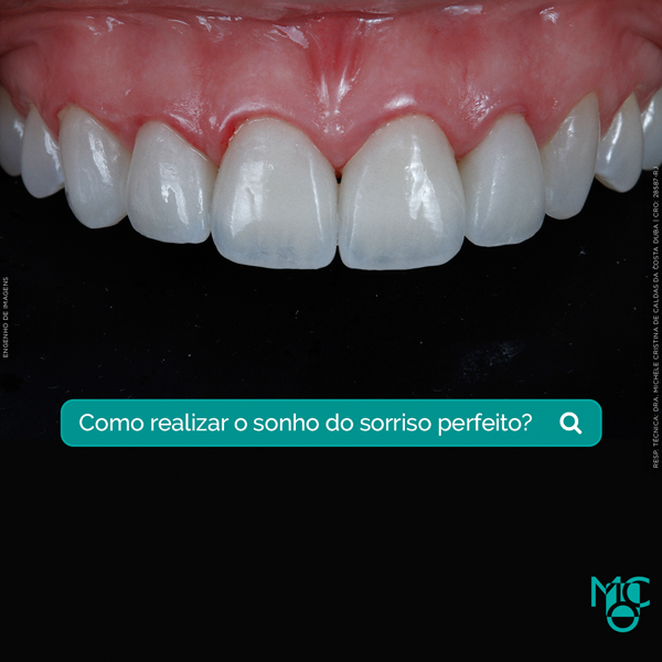Como realizar o sonho do sorriso perfeito?